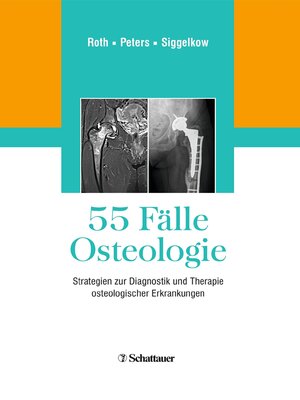 cover image of 55 Fälle Osteologie